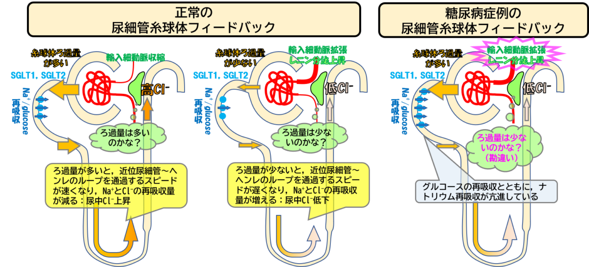 糸球体内圧を理解して得する2つのこと【蛋白尿やGFRとの関係】 循環器Drぷーのコソ勉る〜む